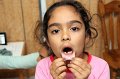 Hailey-tooth